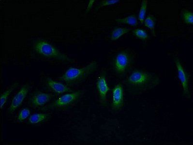 PVRIG antibody