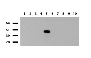 PX19 (PRELID1) antibody