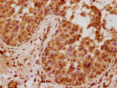 PYCARD Antibody
