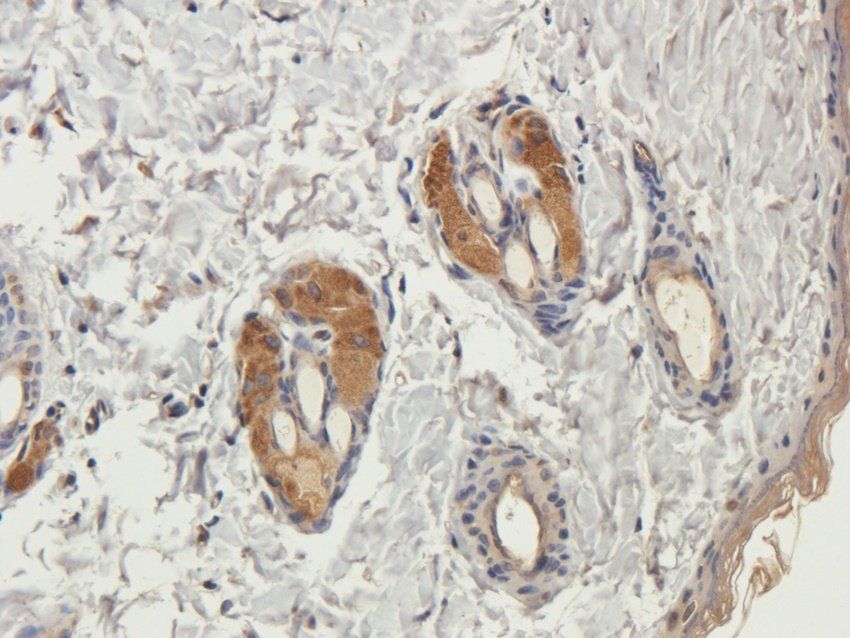 PYCR1 antibody