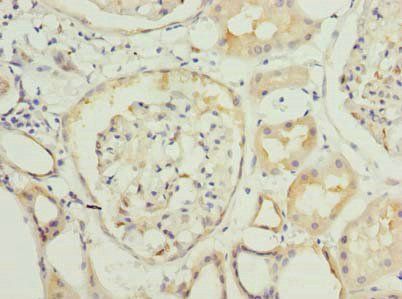 PYCR2 Antibody