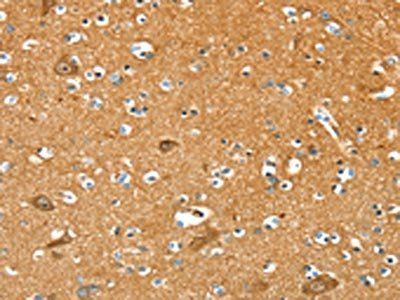 PYGL Antibody