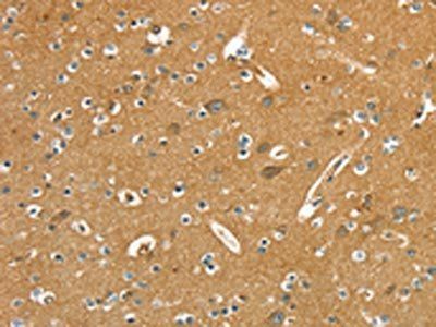 PYGL Antibody