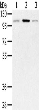 PYGM Antibody