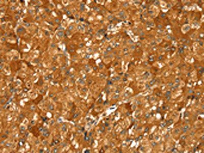 PYGM Antibody