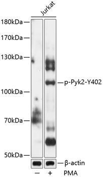 Pyk2 (Phospho-Y402) antibody