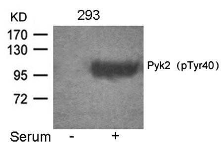 Pyk2 (Phospho-Tyr402) Antibody