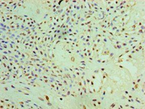 Pyrroline-5-carboxylate reductase 1, mitochondrial antibody