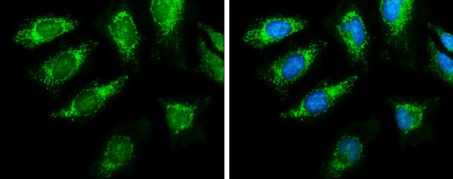 pyruvate dehydrogenase E1 alpha 1 subunit Antibody