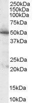 Goat anti-Pyruvate dehydrogenase / PDHX Antibody