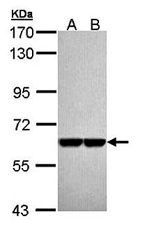 Pyruvate Kinase(liver/RBC) antibody
