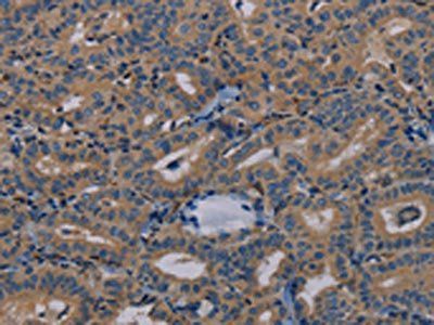 PYY Antibody