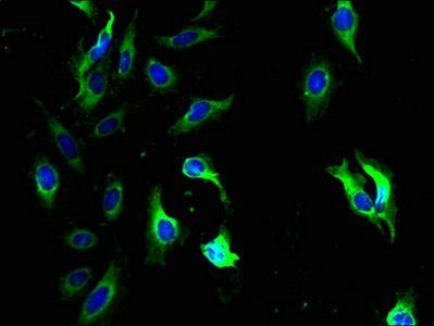 QPCTL Antibody