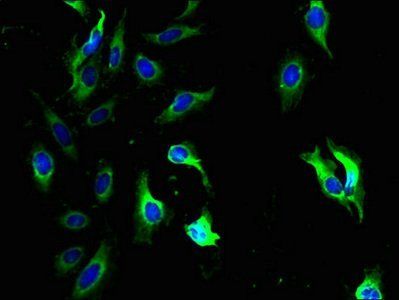 QPCTL antibody