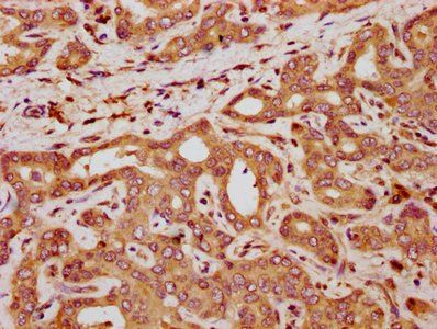 QPRT Antibody