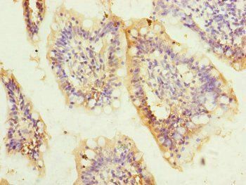 QRSL1 Antibody
