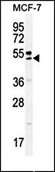 QTRTD1 antibody