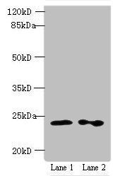 RAB11B Antibody