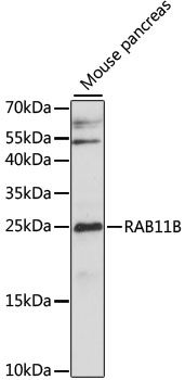 RAB11B antibody