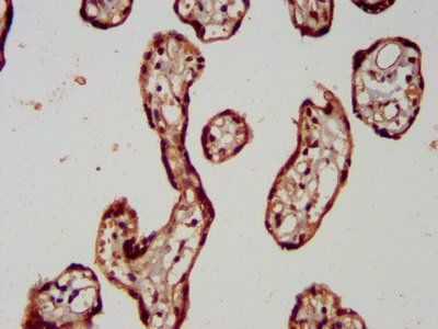 RAB11FIP5 Antibody