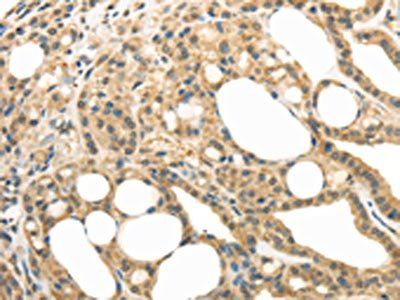RAB17 Antibody