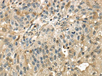 RAB17 antibody