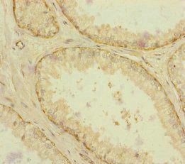 RAB18 antibody