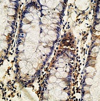 RAB1A Rabbit Polyclonal Antibody