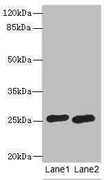 RAB20 antibody