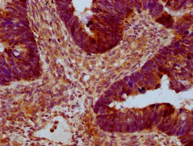 RAB21 Antibody