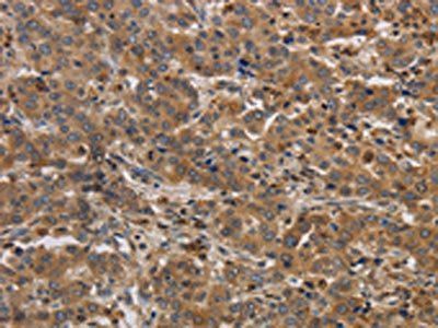 RAB22A Antibody