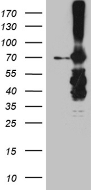 RAB23 antibody