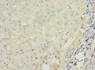 RAB23 Antibody