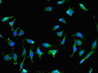 RAB25 antibody