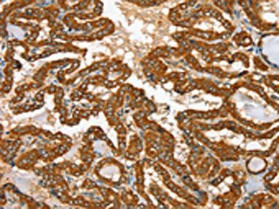 RAB25 antibody