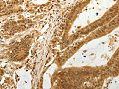 RAB26 Antibody