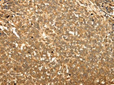 RAB26 Antibody