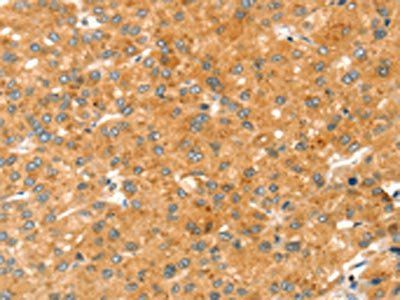 RAB27A Antibody