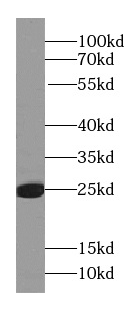 RAB27A-specific antibody