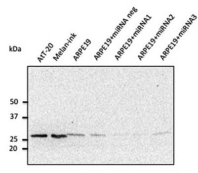 Rab27a antibody