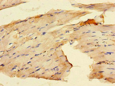 RAB28 Antibody