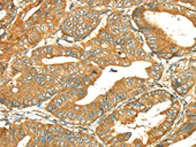 RAB2A Antibody