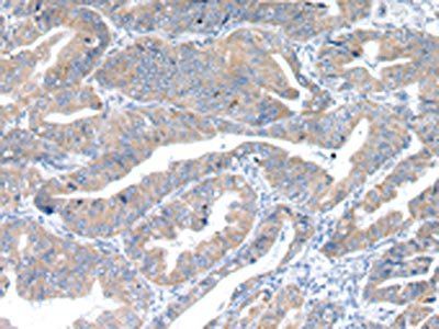 RAB2A Antibody