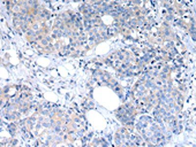 RAB2A Antibody