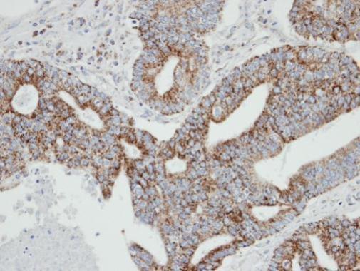 RAB2A antibody [C2C3], C-term
