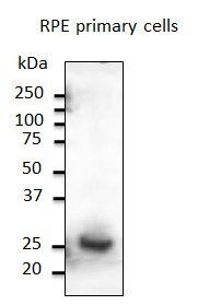 Rab31 antibody