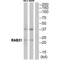 RAB31 antibody