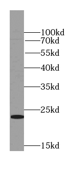 RAB31-specific antibody