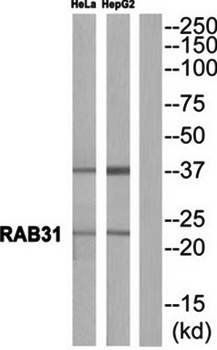 RAB31 antibody