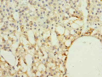RAB33A Antibody
